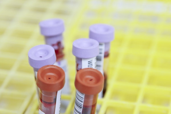 Blood samples