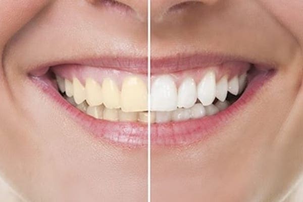 Smile
